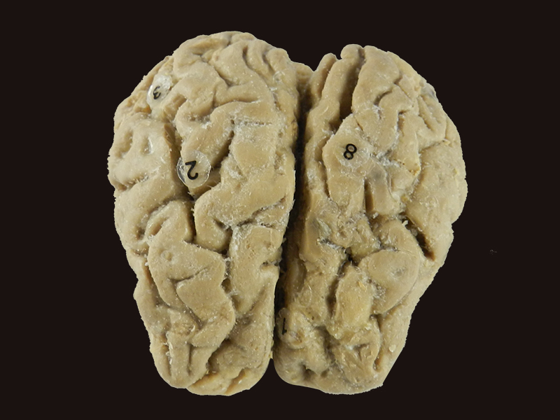 Brain of Horse teaching specimen