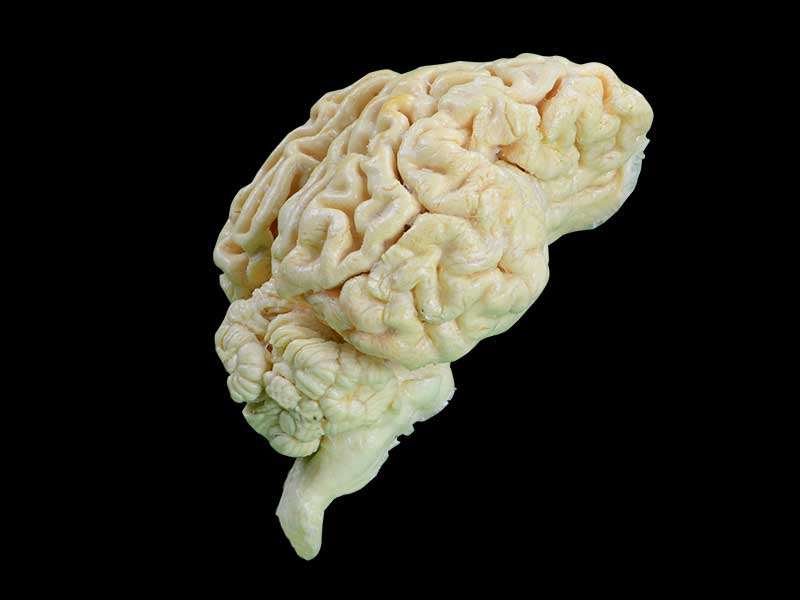 brain of sheep