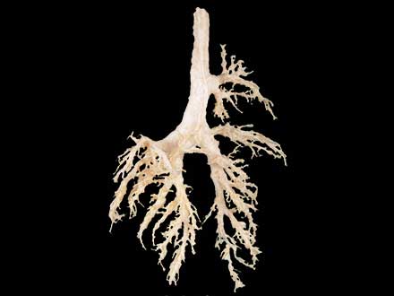 Bronchial tree of cow plastinated specimen