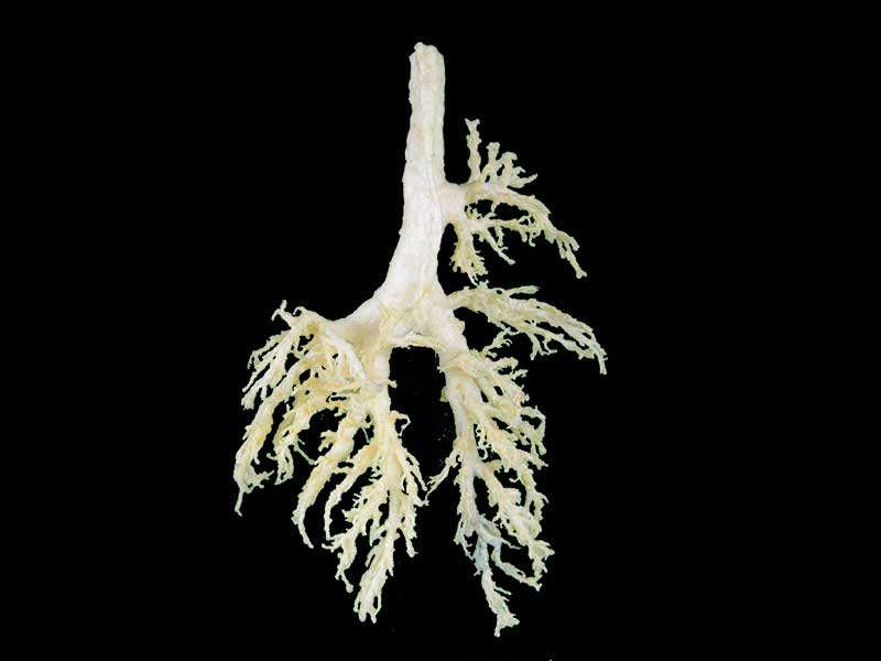 bronchial tree of cow teaching specimen plastination