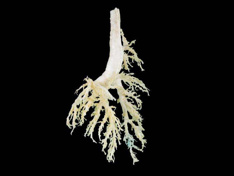 bronchial tree of cow teaching specimen