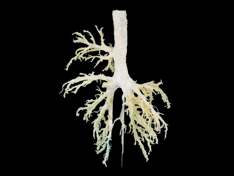 bronchial tree of cow