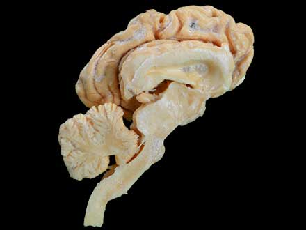 Cattle  brain hemisphere plastinated specimen
