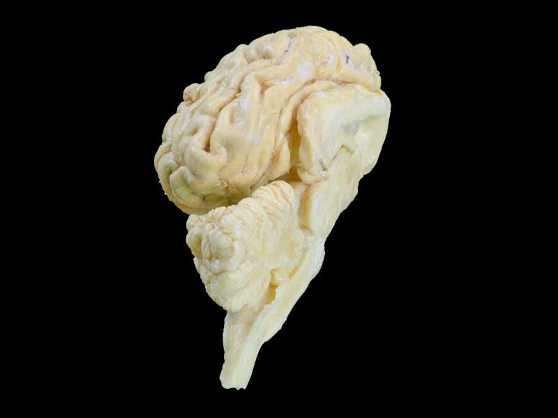 cattle  brain hemisphere specimen plastination