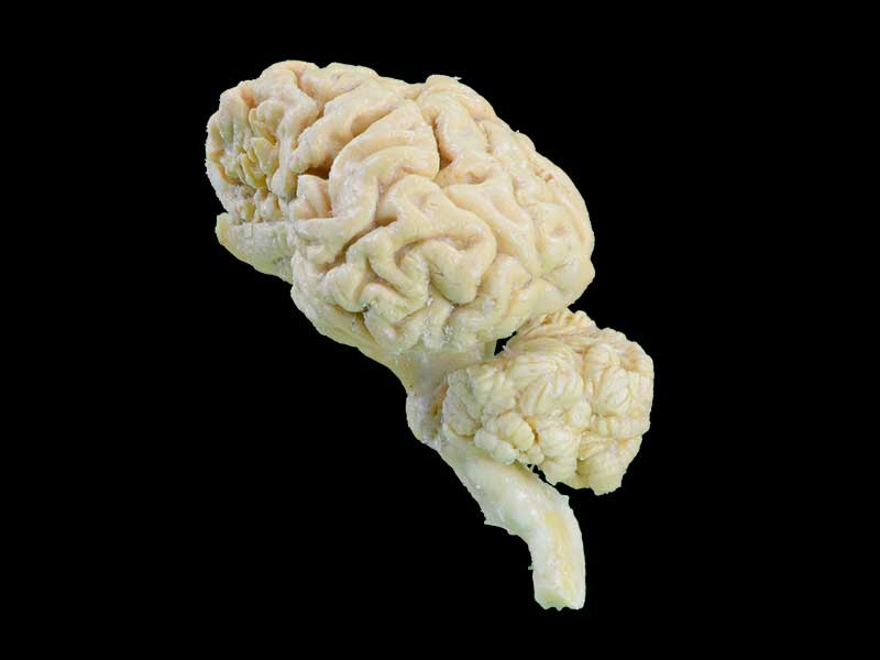 cattle  brain hemisphere teaching specimen