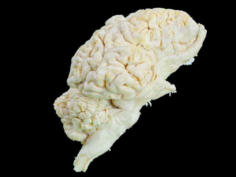 cattle brain teaching specimen