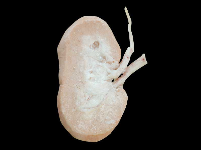 Coronal section of pig kidney plastinated specimen