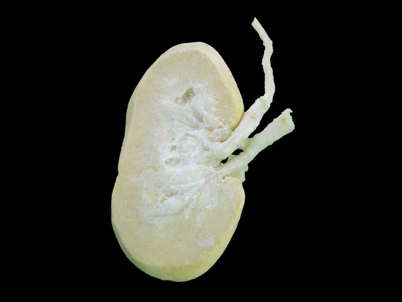 coronal section of pig kidney plastination