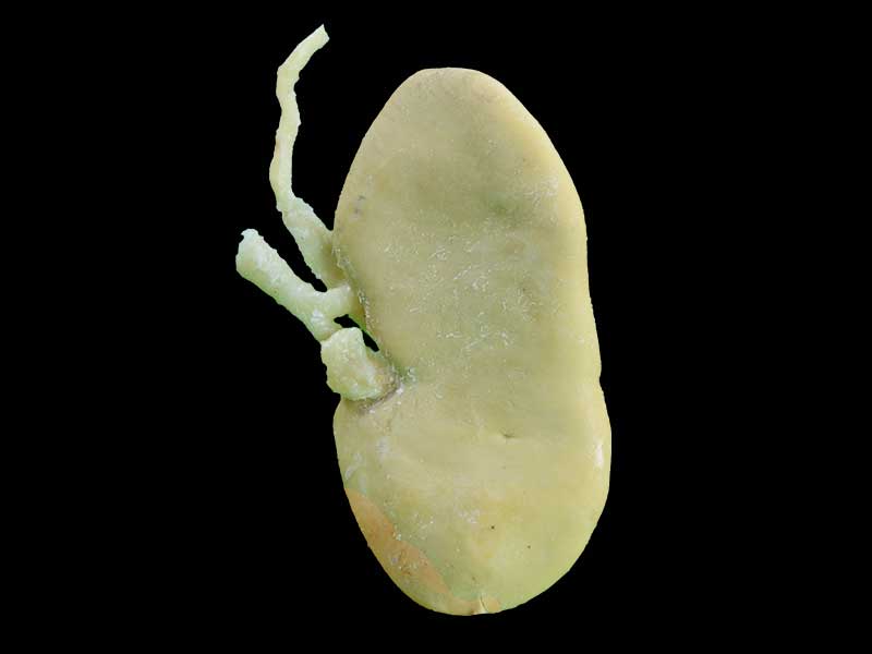 coronal section of pig kidney specimen plastination