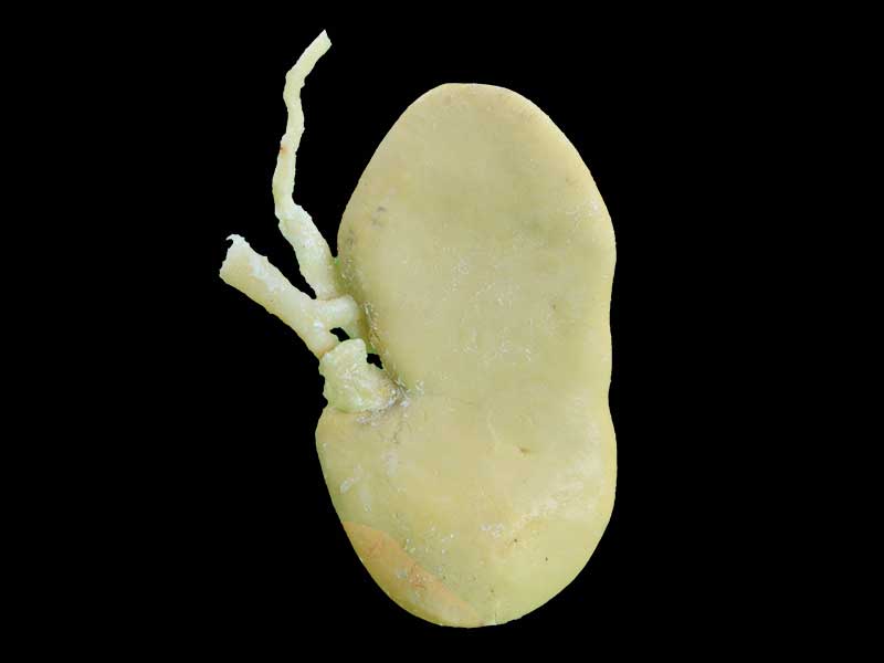 coronal section of pig kidney