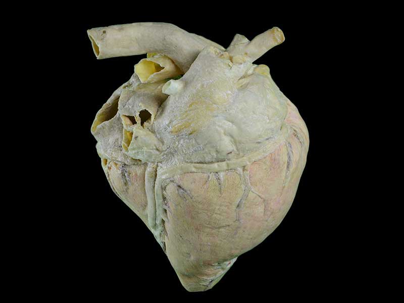 heart blood vessel of cow plastination