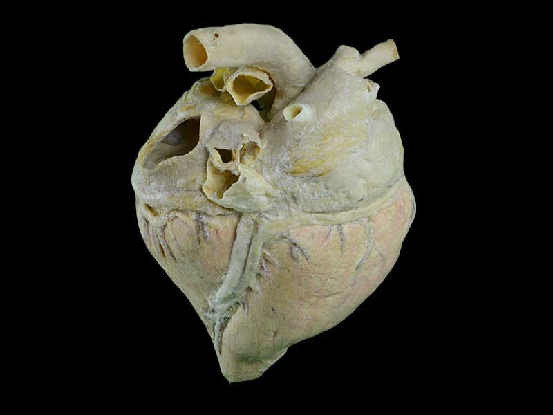 heart blood vessel of cow specimen plastination