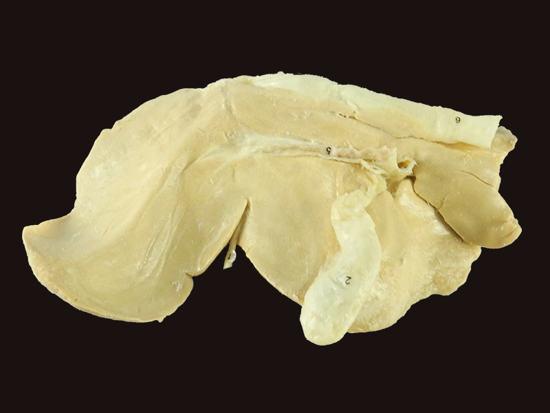 Liver of sheep plastination