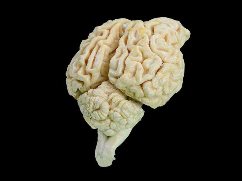 medical brain of sheep plastination