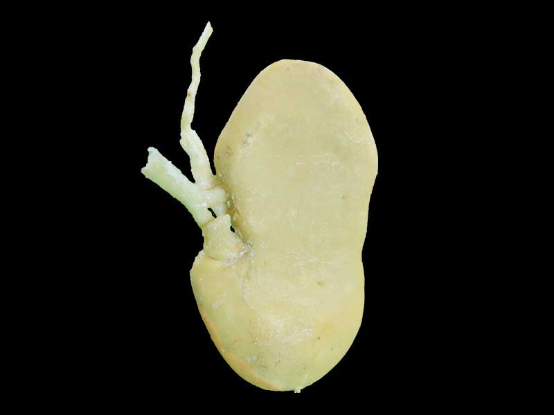 medical coronal section of pig kidney teaching specimen