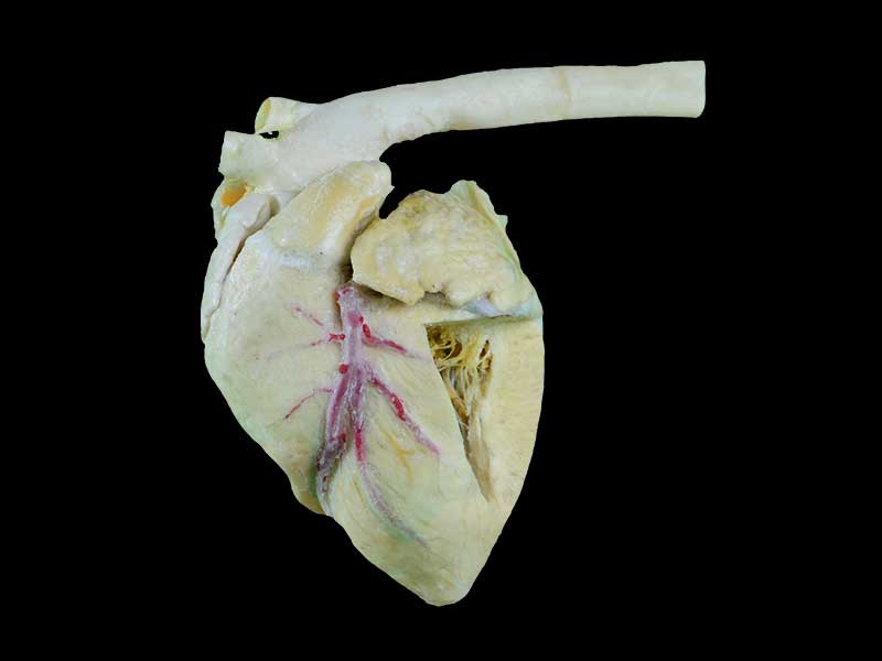 medical Heart cavity of pig specimen