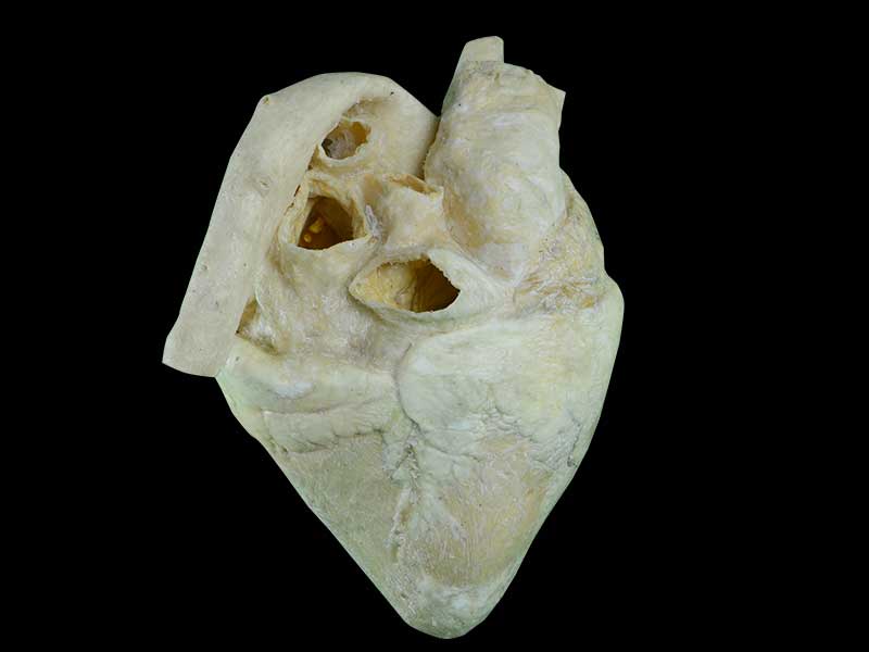 medical heart of cow plastination