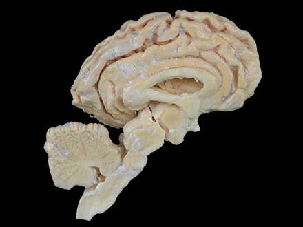 Pig brain hemisphere plastinated specimen