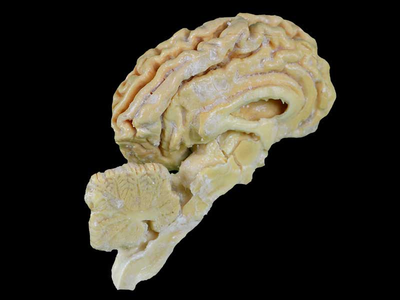 Pig brain hemisphere plastination specimen