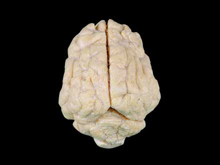Pig brain plastinated specimen
