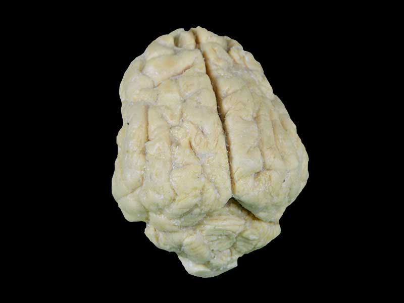 Pig brain plastination specimen