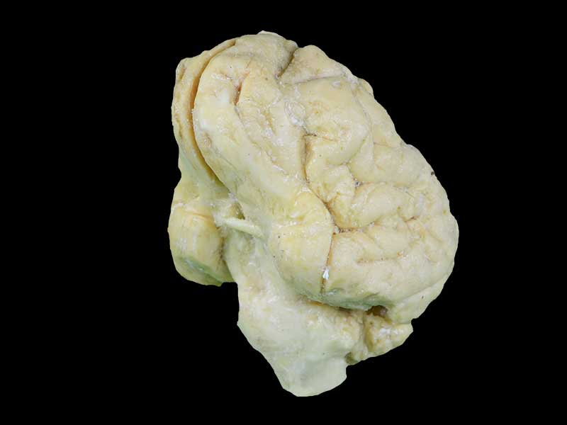 Pig brain