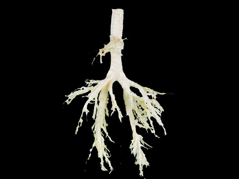 Sheep bronchial tree plastination