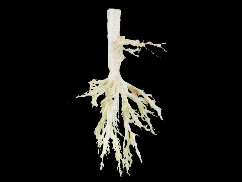 Sheep bronchial tree