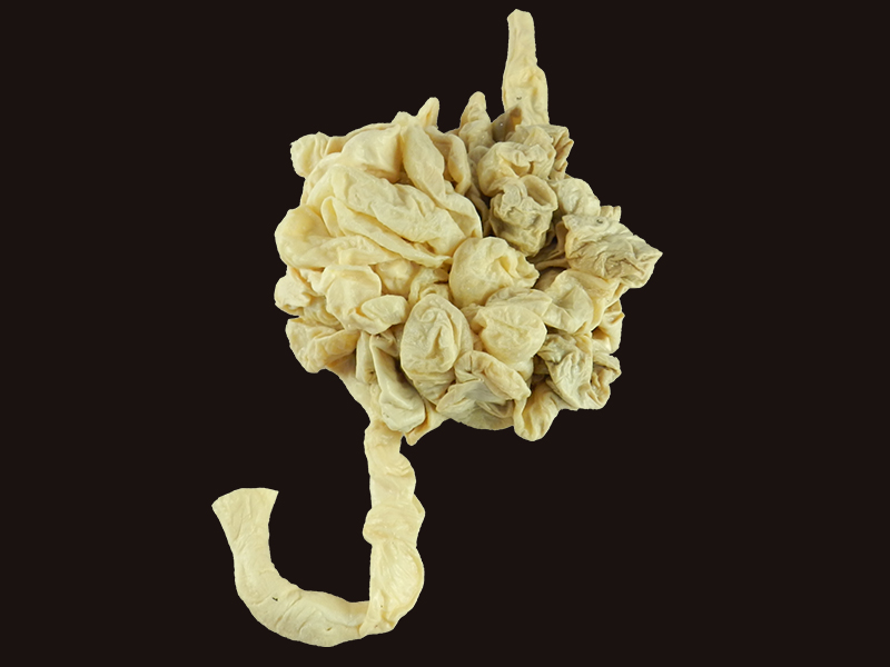 Small intestine of horse medical specimen