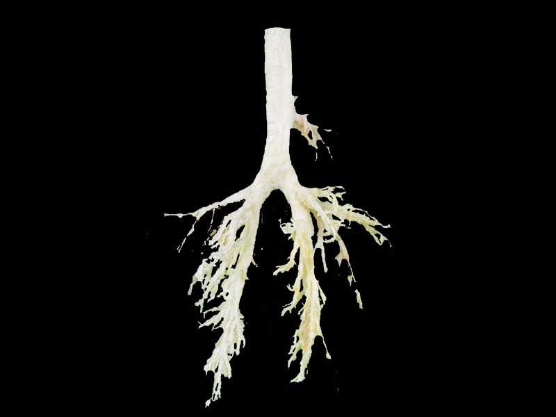 The anatomy of sheep bronchial tree plastination