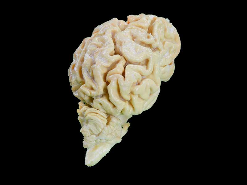 The brain hemisphere of dog plastinated anatomy specimen