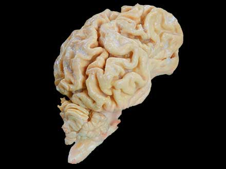 The brain hemisphere of dog plastinated specimen