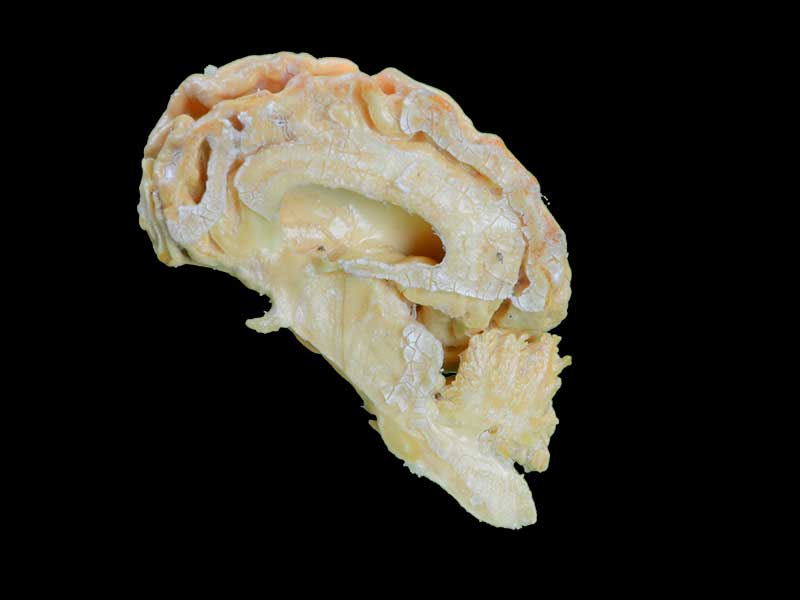 The brain hemisphere of dog plastination animal specimen