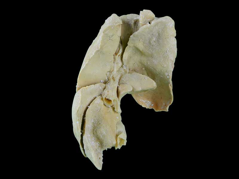 The liver of dog plastination specimen