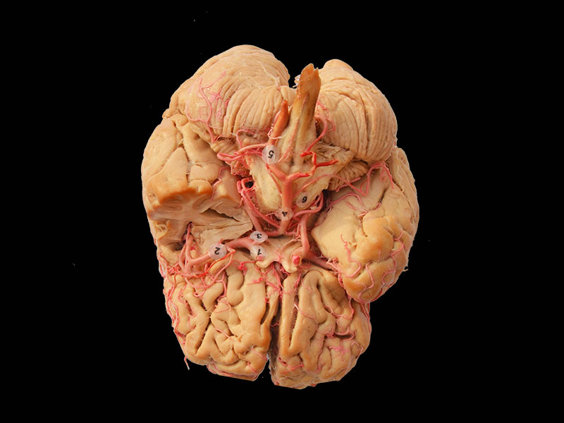 Plastination arteries of base of the brain