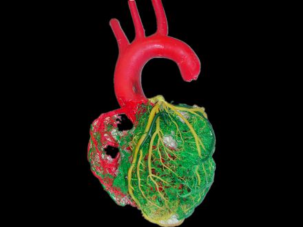 Cardiovascular casting specimens (anterior)