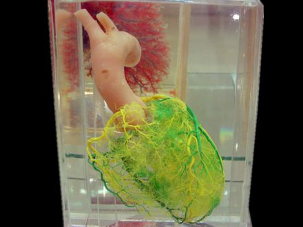 Cardiovascular casting specimens