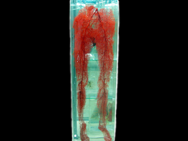 Double lower limb artery casting specimens