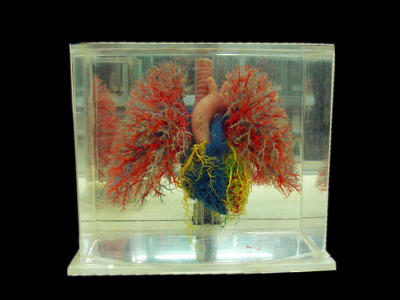 heart lung vascular casting specimens