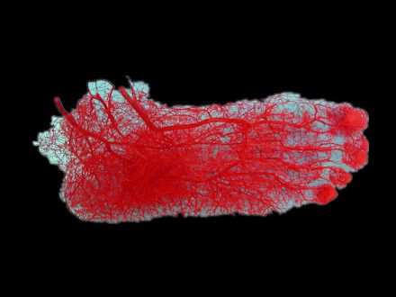 Foot artery casting specimens