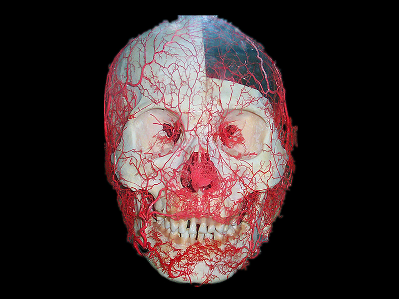 Head artery casting specimens