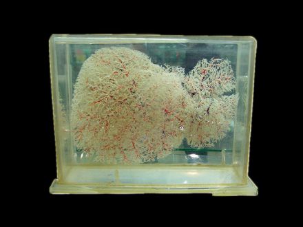 Liver blood vessel  casting specimens