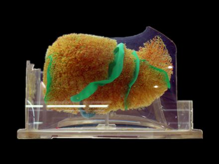 Liver vascular casting specimens