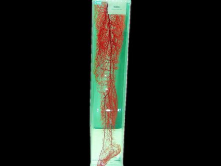 Lower limb artery casting specimens