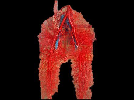 Pelvic artery casting specimens