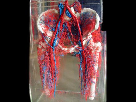 Pelvic vascular casting specimens