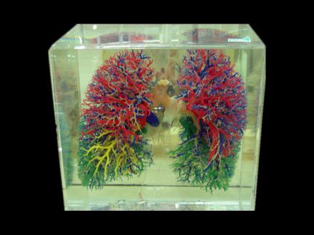 Pulmonary vascular casting specimens