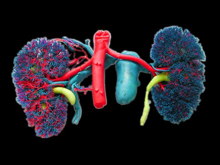 Renal vascular casting specimens