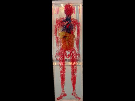 Systemic blood vessel  casting specimens 