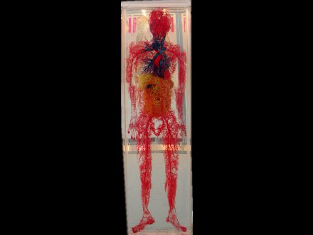 Systemic blood vessel  casting specimens 